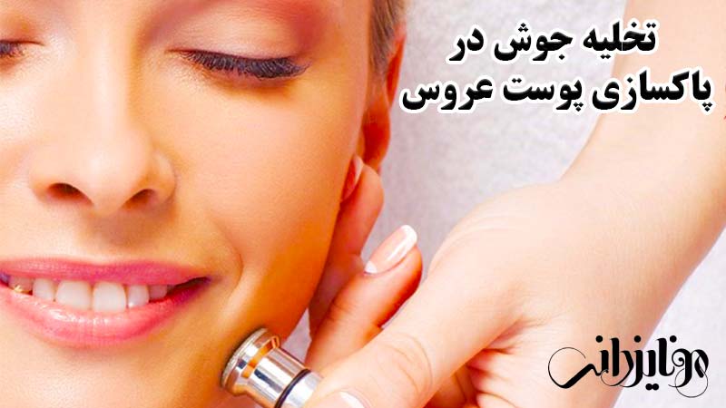 پاکسازی پوست عروس 2 پاکسازی جوش صورت عروس