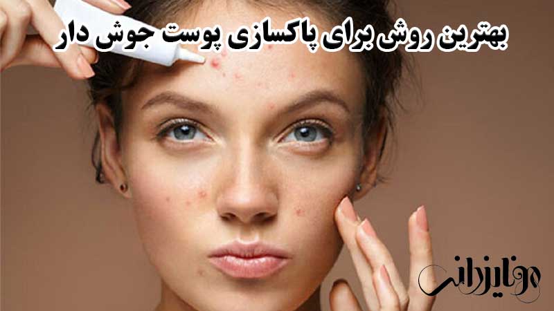 بهترین روش برای پاکسازی پوست صورت 8 بهترین روش برای پاکسازی پوست جوشدار