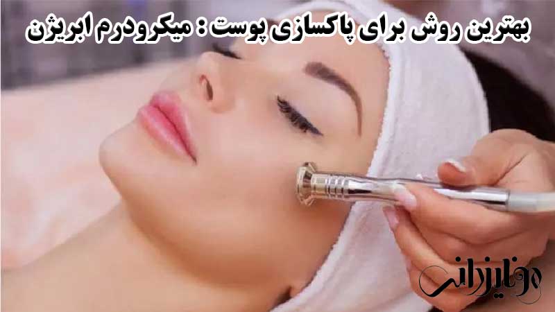 بهترین روش برای پاکسازی پوست صورت 5 بهترین روش برای پاکسازی پوست، میکرودرم ابریژن