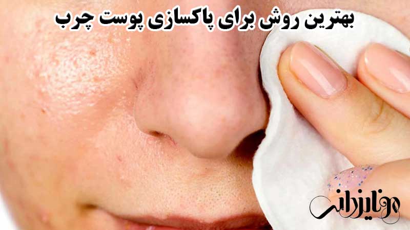 بهترین روش برای پاکسازی پوست صورت 7 بهترین روش برای پاکسازی پوست چرب