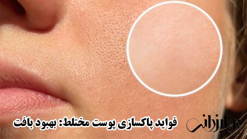 فواید پاکسازی پوست مختلط: بهبود بافت