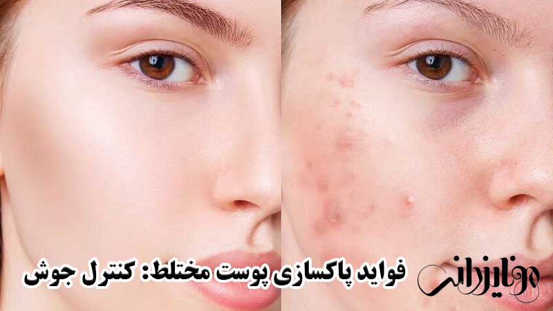 فواید پاکسازی پوست مختلط