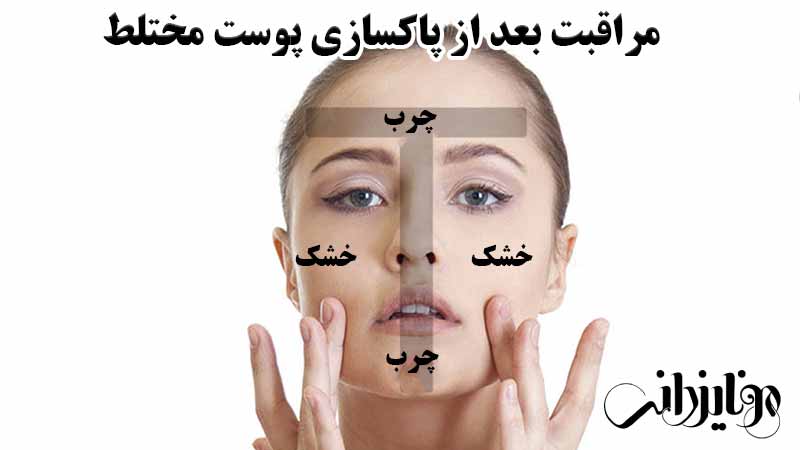 مراقبت بعد از پاکسازی پوست مختلط