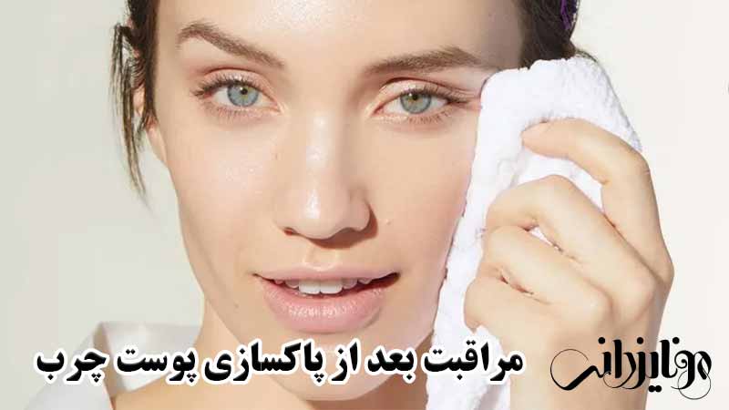 مراقبت بعد از پاکسازی پوست چرب و مستعد آکنه