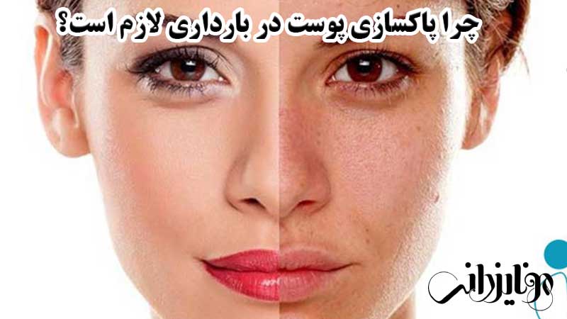 پاکسازی پوست در بارداری 2 چرا پاکسازی پوست در بارداری لازم است؟