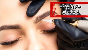 میکروبلیدینگ غرب تهران