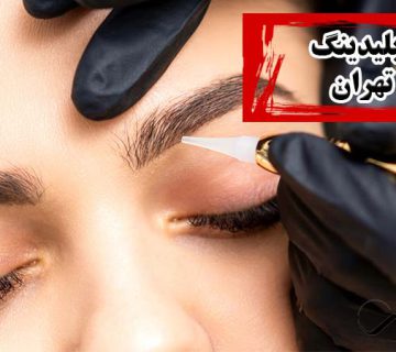 میکروبلیدینگ غرب تهران