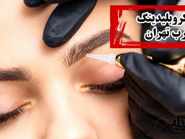 میکروبلیدینگ غرب تهران