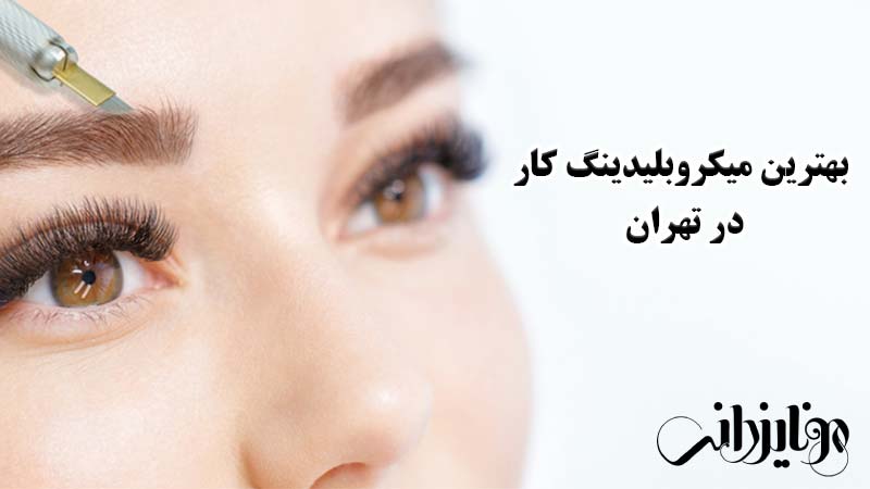 بهترین مرکز میکروبلیدینگ در تهران 1 بهترین میکروبلیدینگ کار در تهران